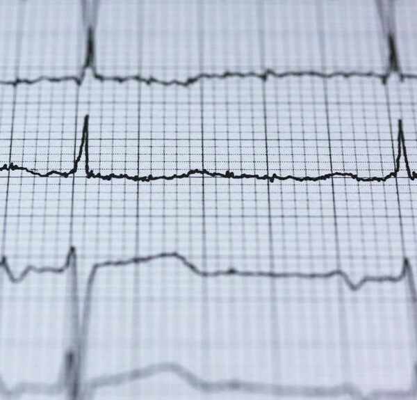 Fusion Pulse 2216583003 Digital Node